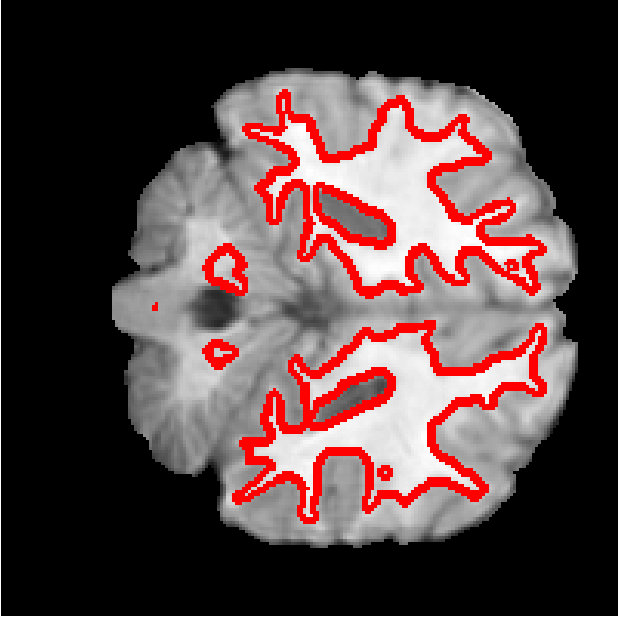 Figure 25